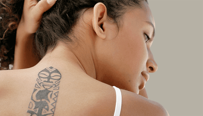 eliminacion-tatuajes-laser-despigmentante-aparatologia-corporal