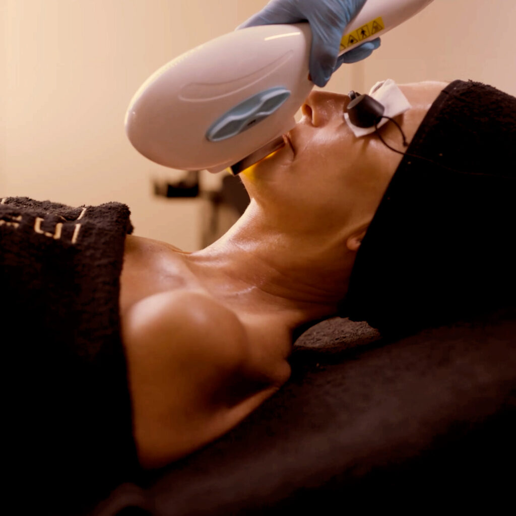 Fhos.-Post-tratamiento-facial-con-Procyon